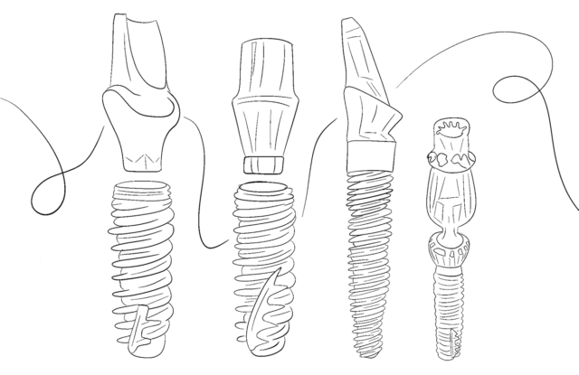 Types of Alpha-Bio Implants Illustration