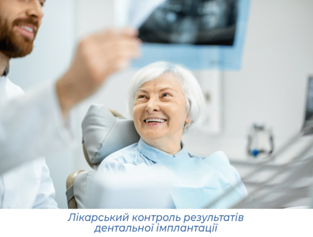 Лікарський контроль результатів дентальної імплантації