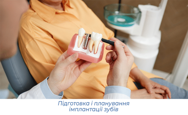 Підготовка і планування імплантації зубів
