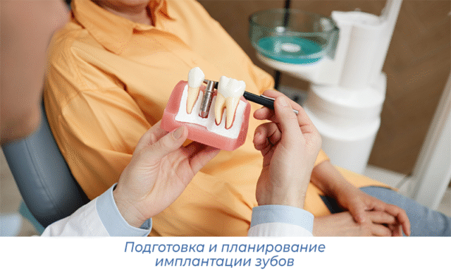 Подготовка и планирование имплантации зубов
