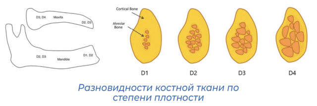 Разновидности костной ткани по степени плотности