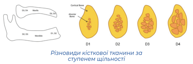 Різновиди кісткової тканини за ступенем щільності