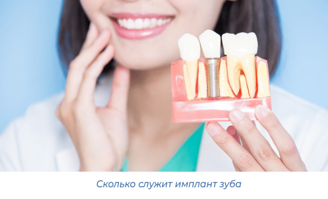 Сколько служит имплант зуба