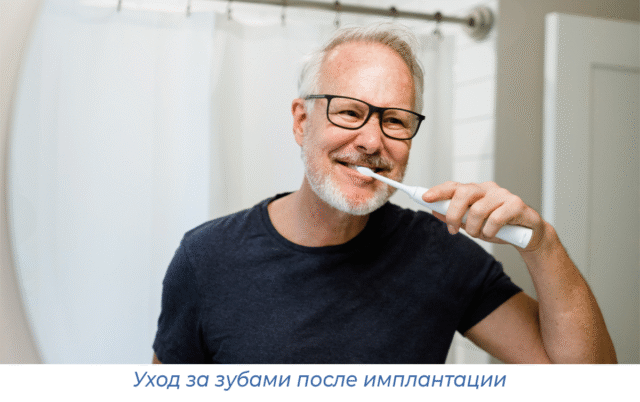 Уход за зубами после имплантации