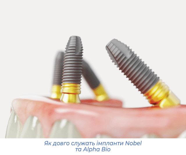 Як довго служать імпланти Nobel та Alpha Bio