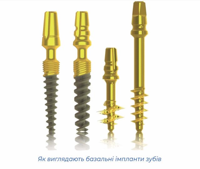 Як виглядають базальні імпланти зубів