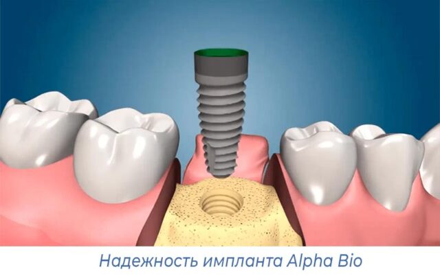 Надежность импланта Alpha Bio