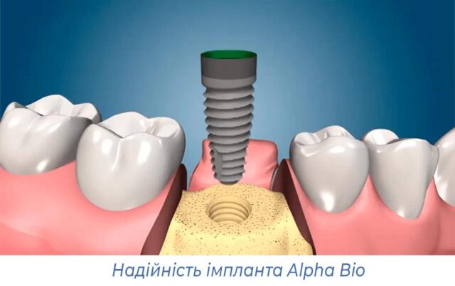 Надійність імпланта Alpha Bio