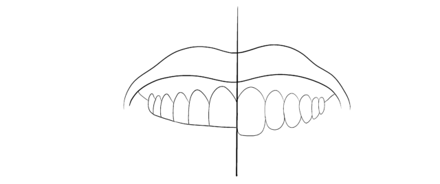 What to pay attention to:

Teeth... Illustration