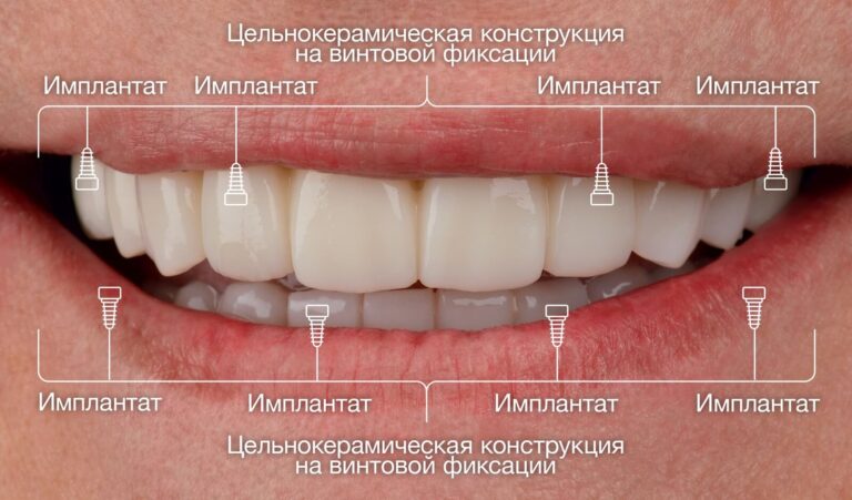 JEWUuncJdSIvXtrsVoCrXQTTeRSd-2_RU