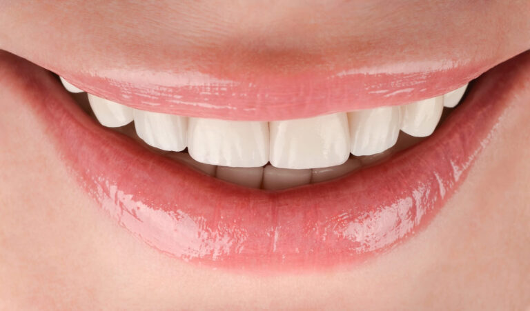 Total reconstruction in case of pathological abrasion