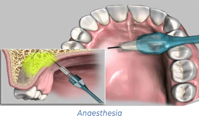 Anaesthesia
