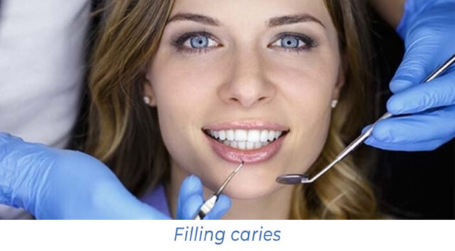 Filling caries