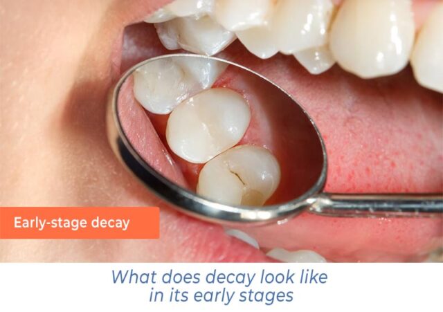 What does decay look like in its early stages