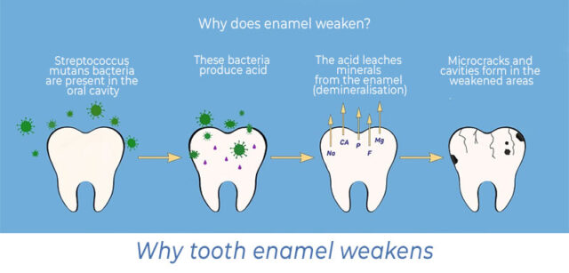 Why tooth enamel weakens