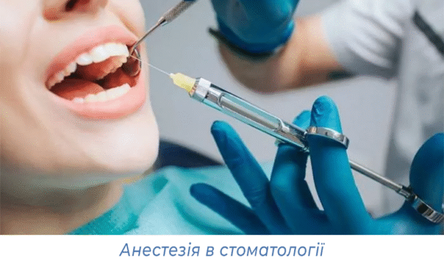 Анестезія в стоматології