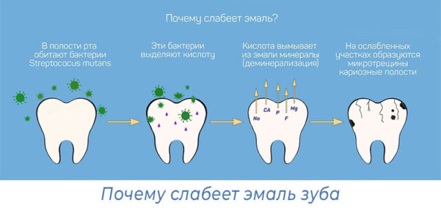 Почему слабеет эмаль зуба