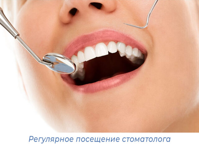 Регулярное посещение стоматолога