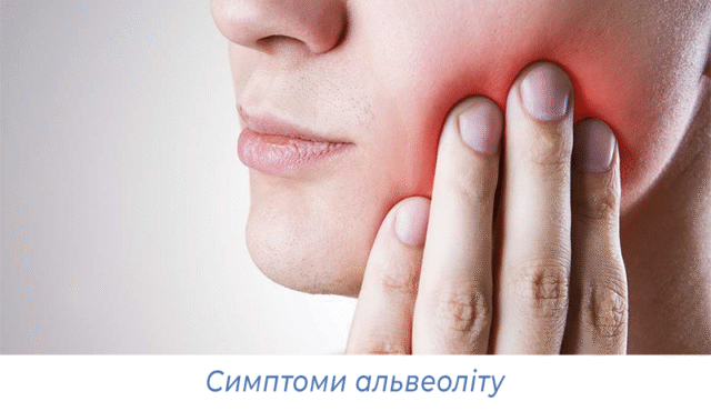 Симптоми альвеоліту