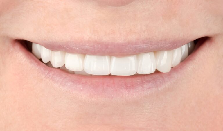 Types of fixed dental prosthetics. Photo after