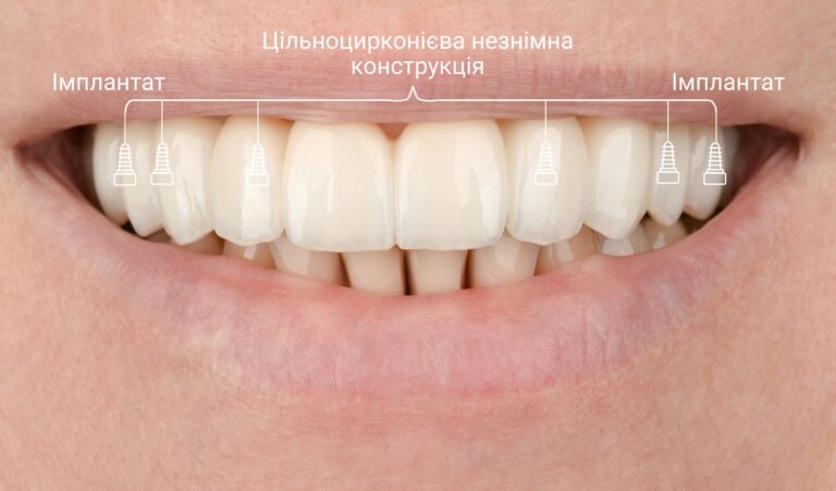. Фото після