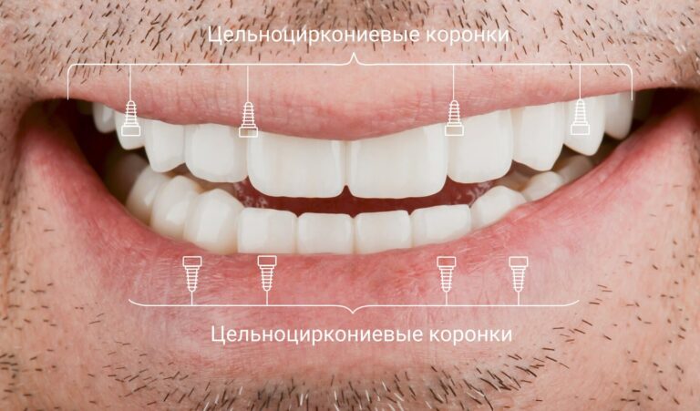 27psRa0-schema-ru