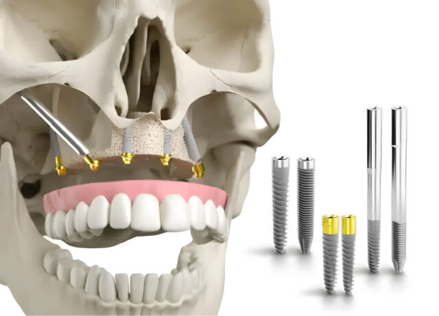 What does the system consist of? Illustration