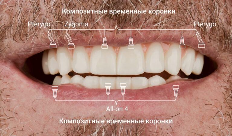 Из чего состоит система?. Фото после